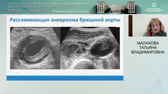 к.м.н. Татьяна Владимировна Малахова, 19.02.22