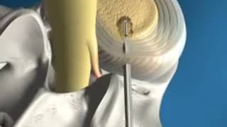 Гидропластика смотреть онлайн