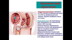 ОСТРЫЙ И ХРОНИЧЕСКИЙ ПРОСТАТИТ  1 часть