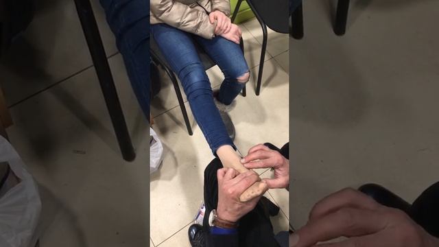Упражнения при плоскостопии у девочки 11 лет