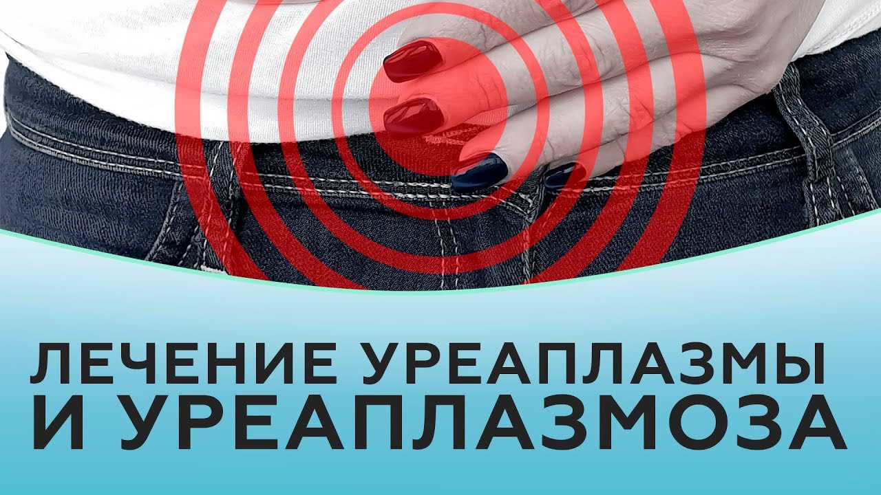 Лечение уреаплазмы и уреаплазмоза.