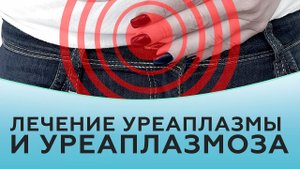 Лечение уреаплазмы и уреаплазмоза.