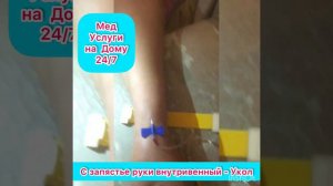 Медицинские Услуги на Дому: 24/7 как правильно ставить капельницу С запястье руки
