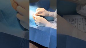 DRENAGGIO DI CISTI SEBACEA DEL VOLTO !