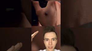 Этот мальчик утверждал, что он стал человеком пауком! И он не врал!