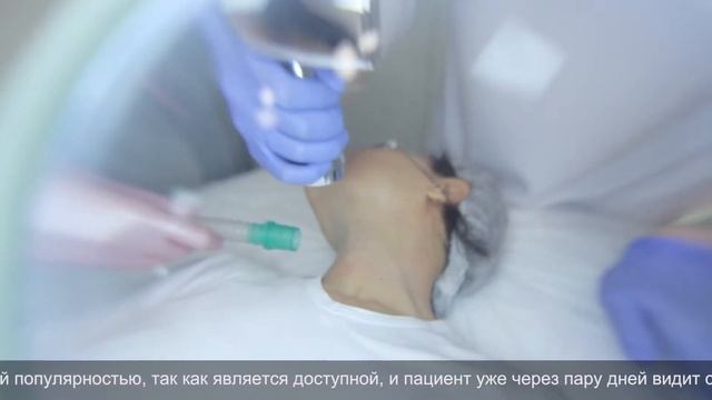 Микролазерный пилинг ZOOM смотреть онлайн