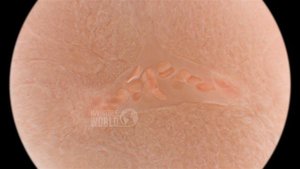 Движение эритроцитов по сосудам под микроскопом. На ранних стадиях развития мальки рыб прозрачные и