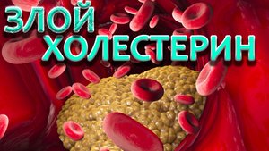 О плохом холестерине