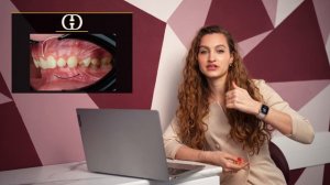 Как изменилось лицо после брекетов. Разбирает ортодонт