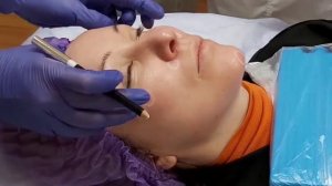 АирисКом студенты учатся: разметка для введения филлера при коррекции лица. Наталья Андреева.