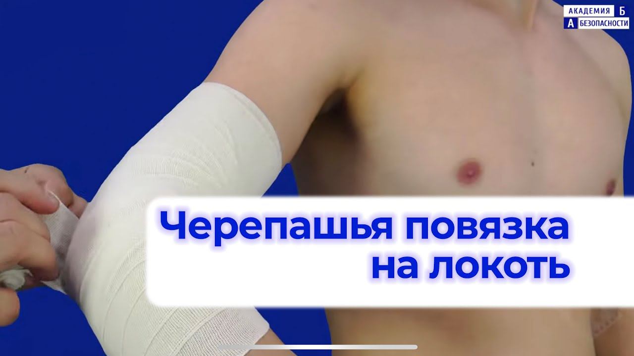 Техника наложения черепашьей повязки. Наложение повязки на локтевой сустав. Наложение черепашьей повязки на локтевой сустав. Черепашья повязка на локоть. Черепашья сходящаяся на локтевой сустав повязка.