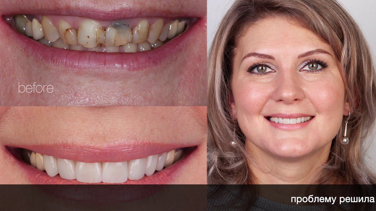 Отзыв Ларисы о Центре стоматологии Орловских (Orlovsky Dental Center Правобережье ) город Калуга