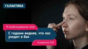 R-моделирование носа | Головатая Ирина Вячеславовна