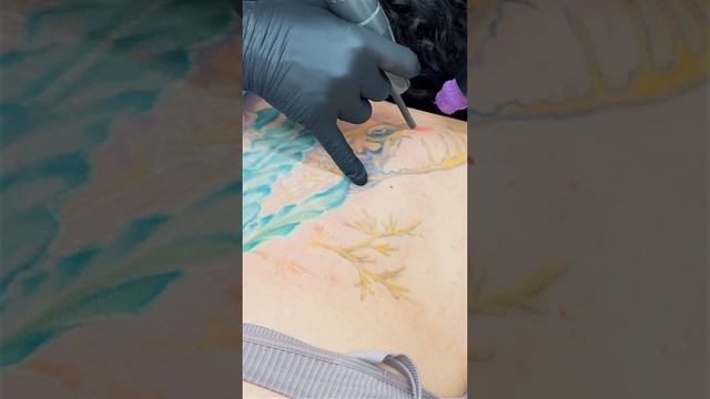Удаляем тату на спине у девушки  ✅  В клинике  лазерного удаления тату "Битый Небитого #удалениетату