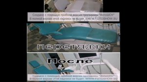 Перетяжка стоматологических кресел