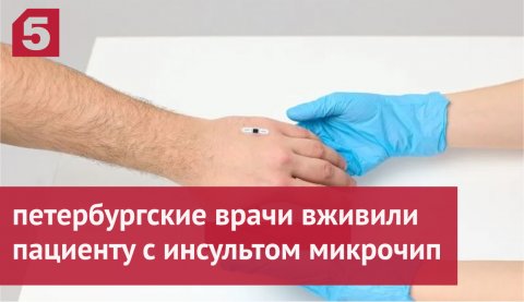 Петербургские врачи вживили пациенту с инсультом микрочип