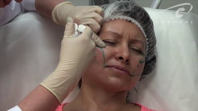 Техника коррекции скуловой области смотреть онлайн