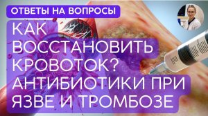 КАК ВОССТАНОВИТЬ КРОВОТОК? АНТИБИОТИКИ ОТ ЯЗВЫ И ТРОМБОЗА.