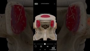 Спондилез поясничного отдела позвоночника. 3D анатомия.
