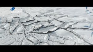 SUPREME Head&Shoulders x Катя Варнава против сухости кожи головы и перхоти!