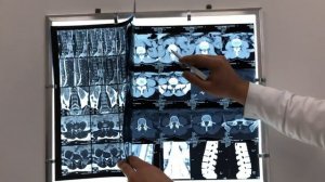 МРТ или КТ позвоночника - что делать, что выбрать?