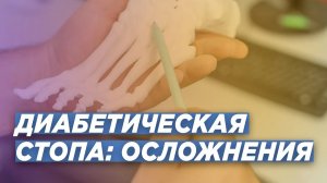 ОСЛОЖНЕНИЯ НА ФОНЕ ДИАБЕТИЧЕСКОЙ СТОПЫ. СТОПА ШАРКО.   ТРАВМАТОЛОГ-ОРТОПЕД ДМН ИГОРЬ ПАХОМОВ.