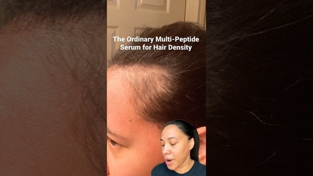 ? The Ordinary Multi-Peptide Serum for Hair Density. #hairgrowth #theordinary #hairloss