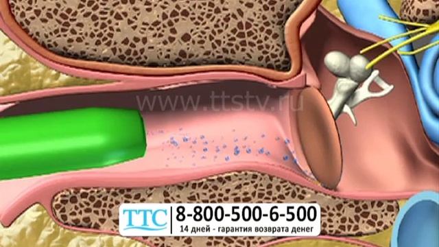 Прибор «Чистые ушки» (чистое ушко). Аппарат для домашней чистки ушей ttstv.ru. смотреть онлайн