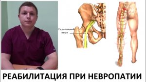 Седалищный нерв Реабилитация при невропатии Medical Rehabilitation Sciatic neuropathy 