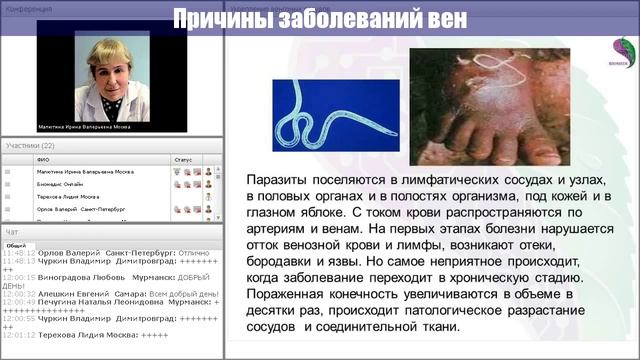 ???Почему Болят Вены???|???Pochemu Boljat Veny??? смотреть онлайн