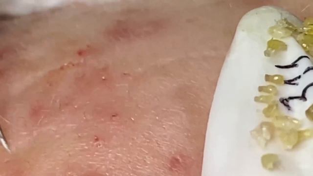 Enjoy Every Day With The Best Video Loan Nguyen Spa Official 2657 смотреть онлайн