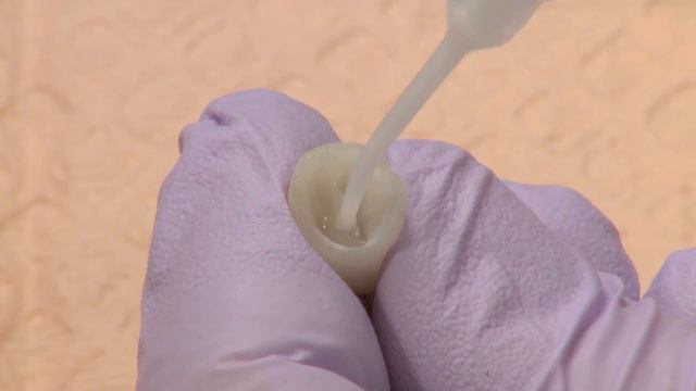 Crown Cementation Using PermaFlo DC смотреть онлайн