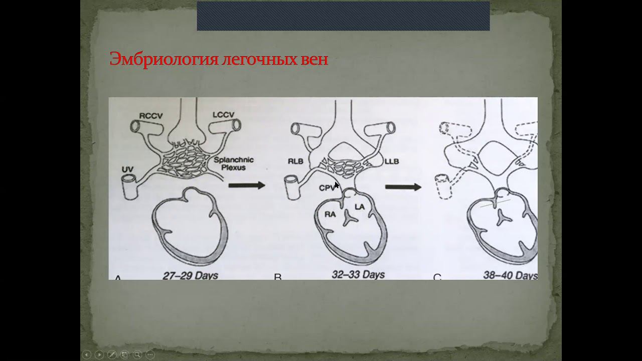 УЗД Критических ВПС Дюжикова