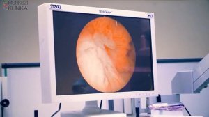 Sidik kisəsi TUR. Трансуретральная резекция мочевого пузыря