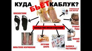 Вред высоких каблуков. Что об этом нужно знать.