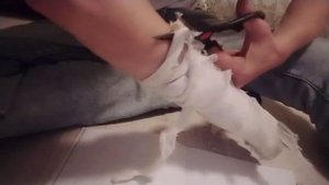 СНИМАЮ ГИПС С РУКИ