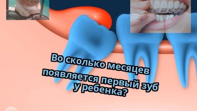 Во сколько месяцев появляется первый зуб у ребенка? смотреть онлайн