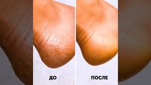 Что можно сделать с банановой кожурой?