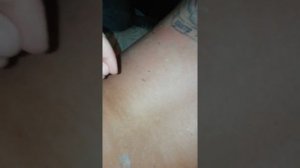 Облазиет кожа после загара