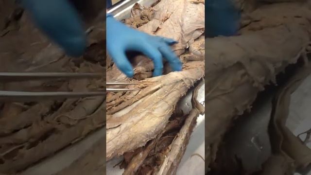 Артерии туловища и артерии нижней конечности смотреть онлайн