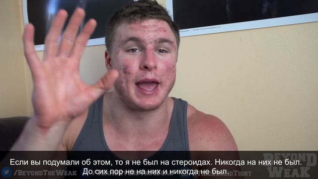 16-ая неделя Роаккутана. Роаккутан - это антистероиды. 3 вещи, которые бесят в акне. Брайан Тернер смотреть онлайн