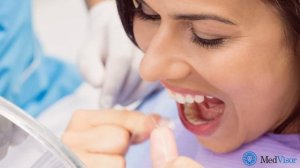 ЧТО ДЕЛАТЬ, ЕСЛИ ЕДА ЗАСТРЕВАЕТ МЕЖДУ ЗУБАМИ