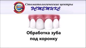 Обработка зуба под коронку