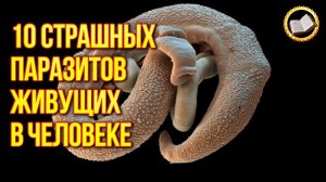 10 страшных паразитов живущих в человеке. Паразиты в человеческом организме