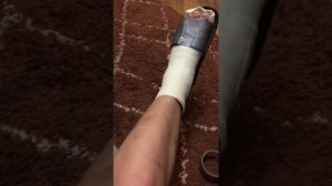 Обувь для того, что бы ходить в гипсе. Выдумка.