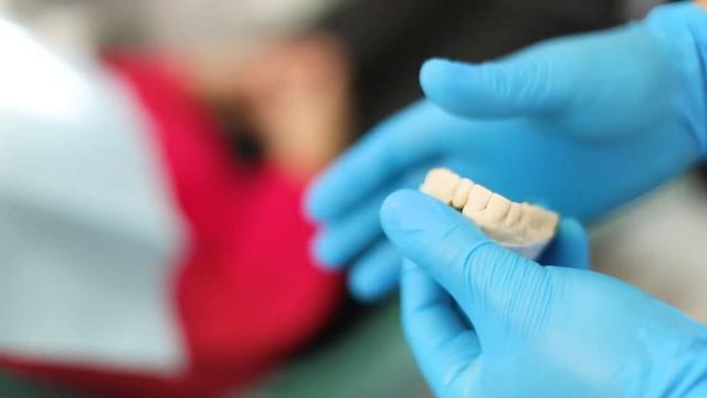 Имплантация зубов в Новосибирске - приоритетное направление сети стоматологических клиник «Блеск» смотреть онлайн