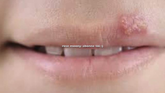 5 BONNES RAISONS DE FAIRE MACÉRER 5 GOUSSES D'AILS ET DE LES UTILISER DANS LE CORPS ! смотреть онлайн