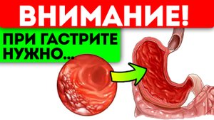 Доктор: зря 99% людей не знают о лечении и простом предотвращении гастрита