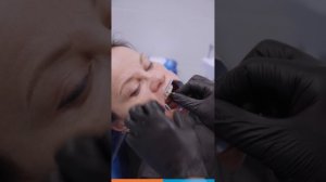 Протезирование переднего зуба на имплантате