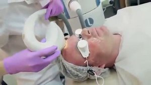 Фотоомоложение лица лазерным аппаратом Lumenis M22 с IPL насадкой